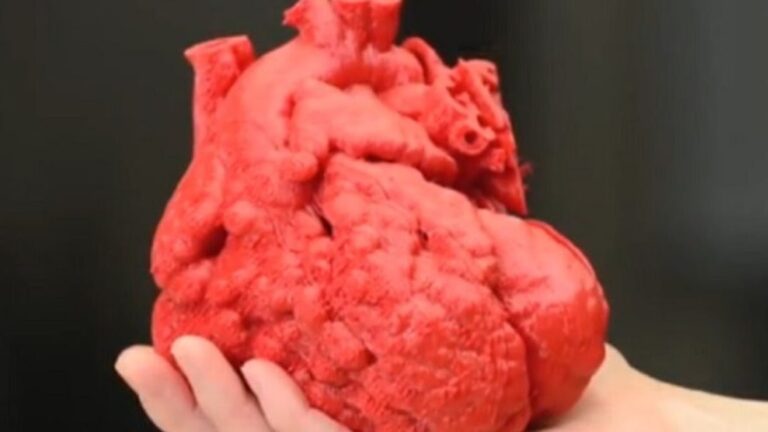 Comment le cœur artificiel Carmat révolutionne-t-il la médecine?